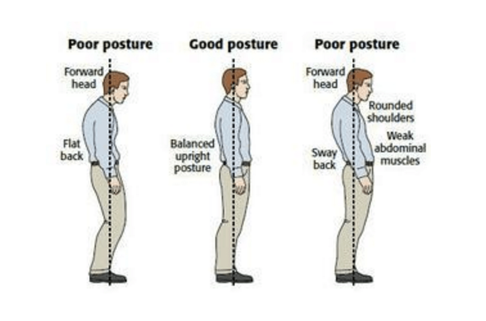 Источник изображения: http://www.thephysiocompany.com/blog/stop-slouching-postural-dysfunction-symptoms-causes-and-treatment-of-bad-posture