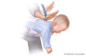 Шаги, чтобы помочь душить детей (1-3) источники: www.webmd.com