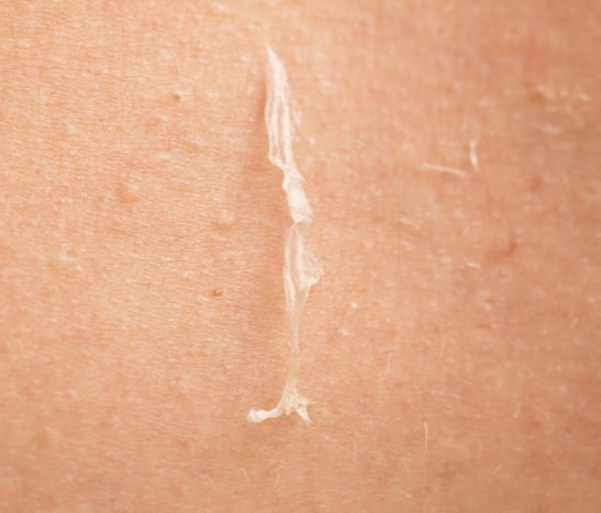 причины преодоления шелушения кожи