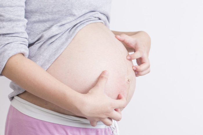 Зудящий фолликулит является причиной зуда кожи во время беременности